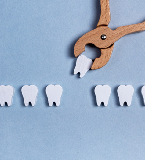 Tooth extraction prices involve many important factors